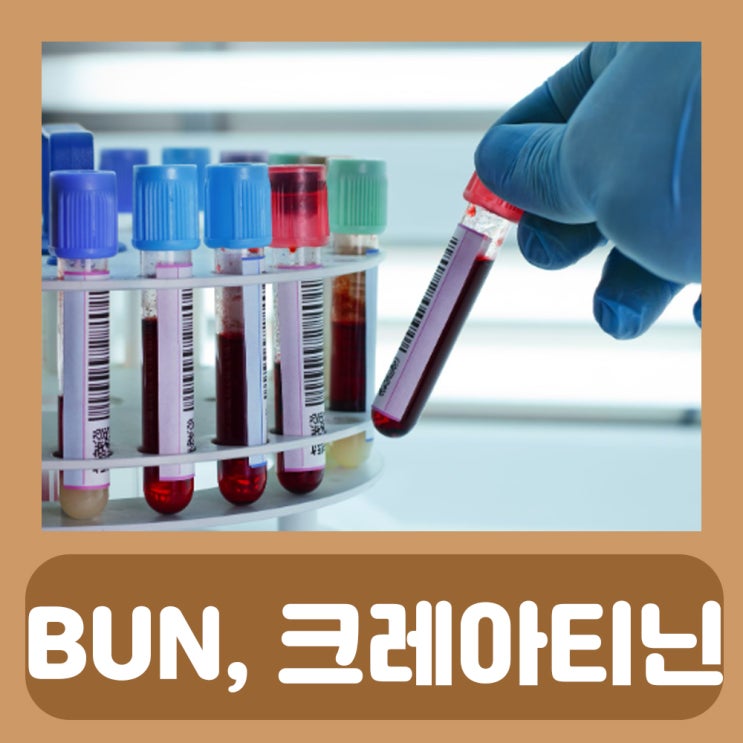  CREATININE 수치 BUN 정상수치 혈청 크레아티닌 수치 요소질소
