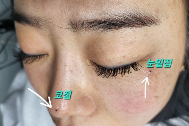  눈빛의변신 전주LED속눈썹연장의 효과.미인점 코점까지 ~