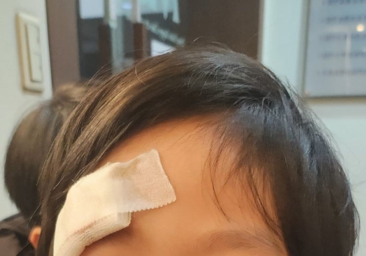  아기 눈썹 이마찢어짐 수원 명성형외과