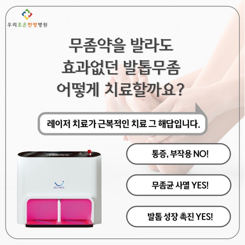 의정부 발톱무좀 무통증 레이저치료로 가능합니다.
