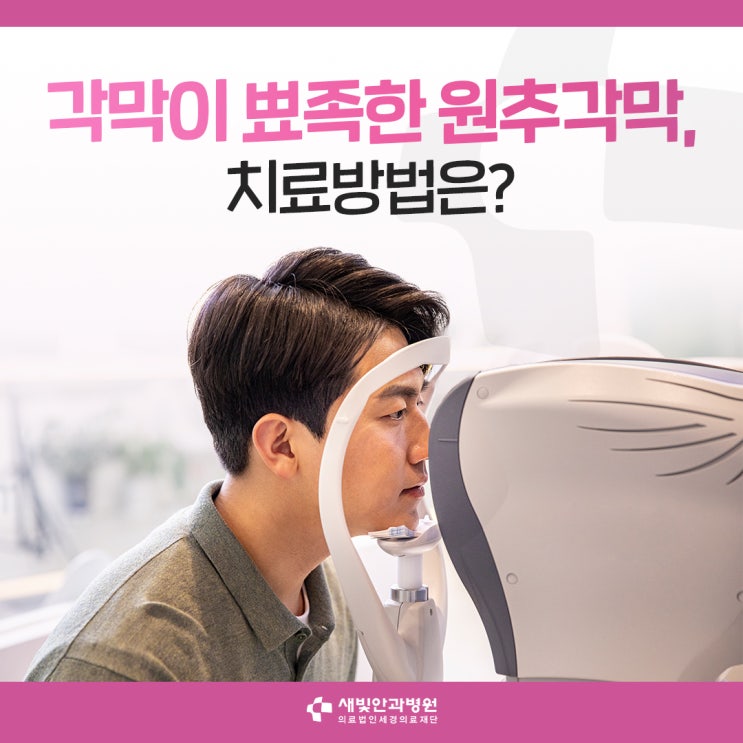  [일산안과] 각막이 뾰족한 원추각막, 치료방법은?