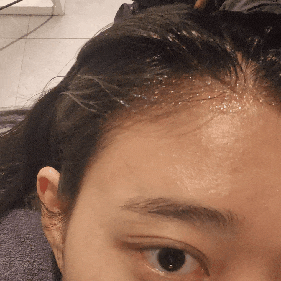  미사 두피관리 웰킨 미사점에서 파워스케일링 받았어요