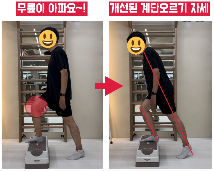  [은평구PT] 무릎통증 회원님 재활PT 후기 2탄!