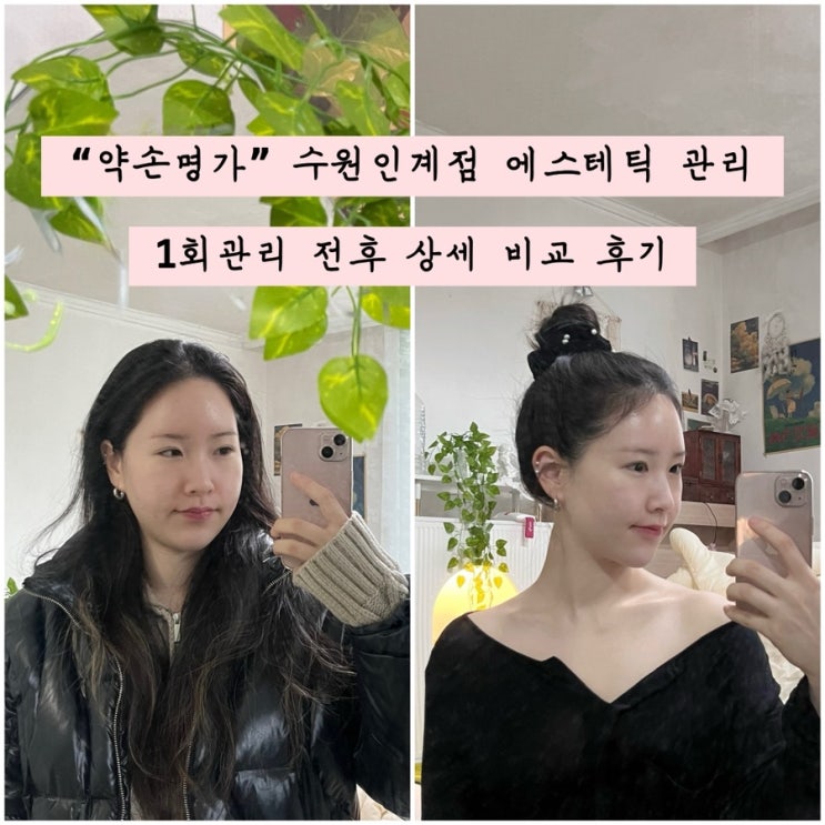  “약손명가” 수원인계점 에스테틱 관리 1회 전후 상세 비교, 윤곽조각얼굴관리 후기