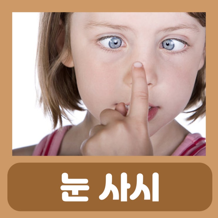  아기 사시 치료 내사시 상사시 간헐적 외사시 아기 눈 사시 증상