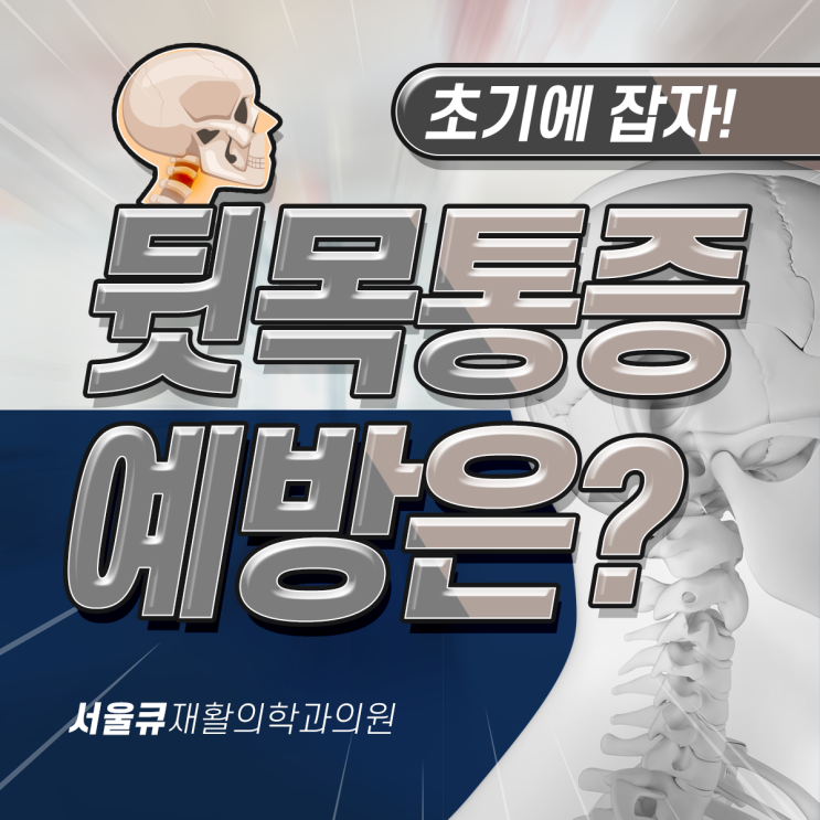  송파동정형외과, 뒷목 뻣뻣함과 목 통증 완화 및 예방