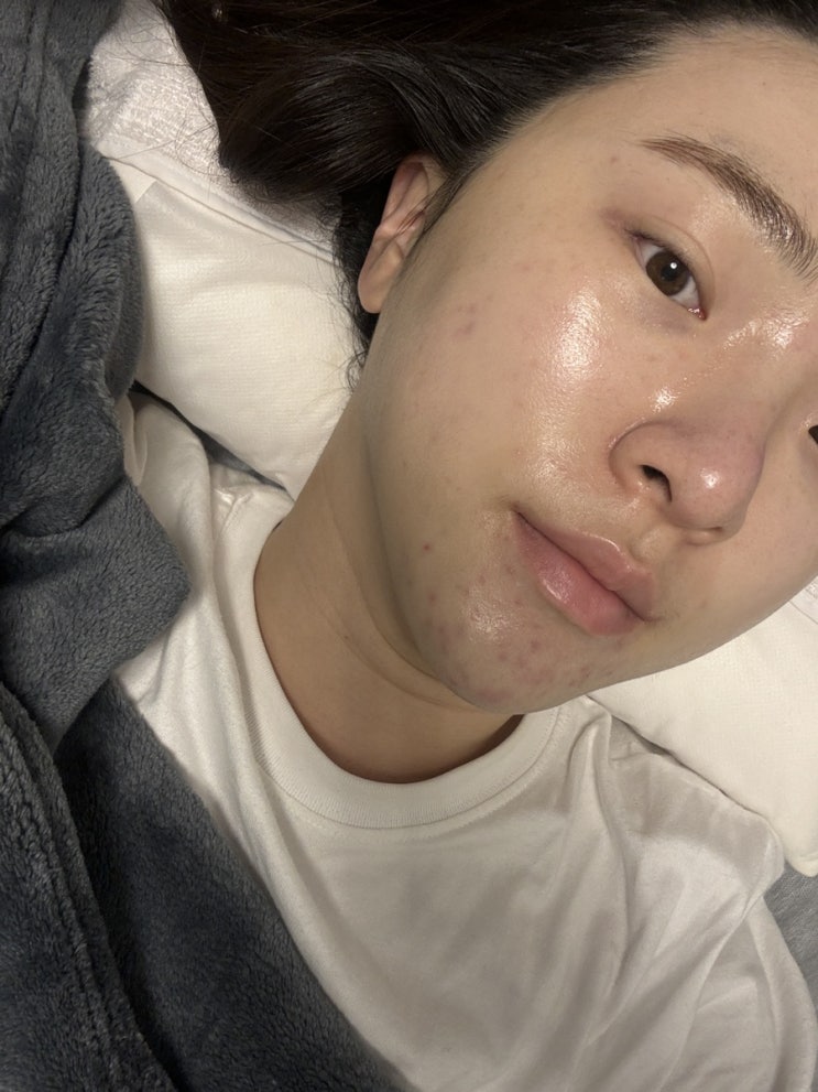  동탄 피부관리 제리아 에스테틱 셀포어관리