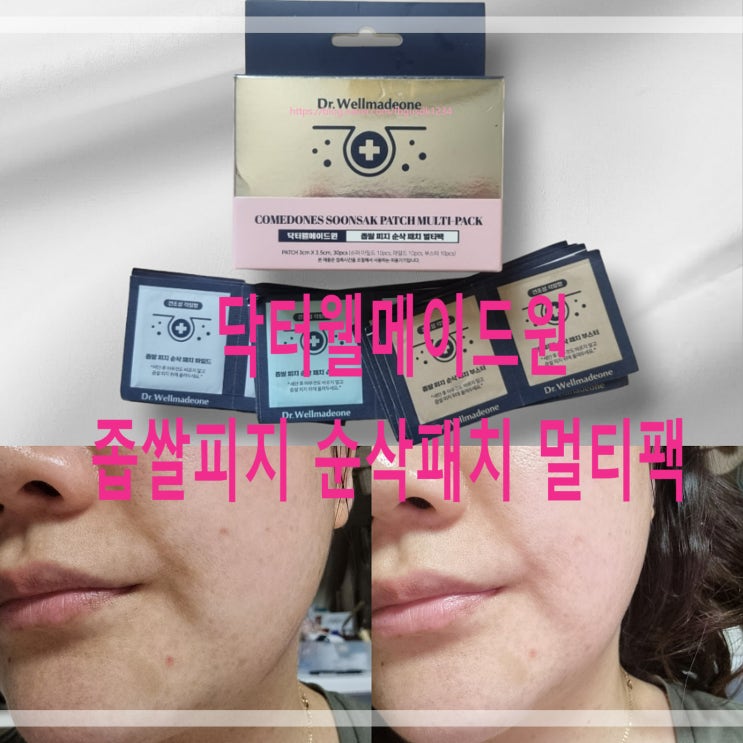  좁쌀피지제거 올리브영패치 닥터웰메이드원 좁쌀피지 순삭패치 멀티팩 사용후기