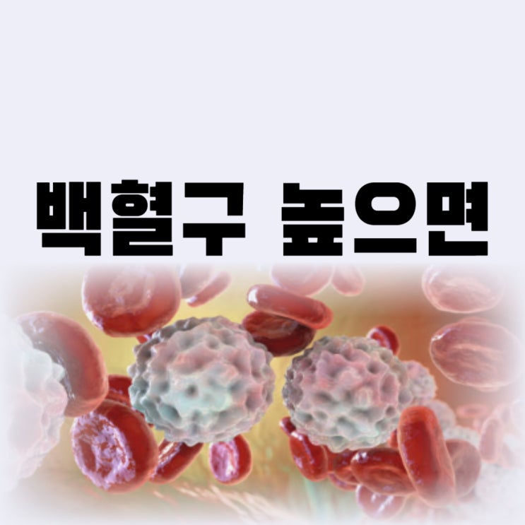  백혈구 수치가 높으면 증상 종류 백혈구 수치 낮추는 법은