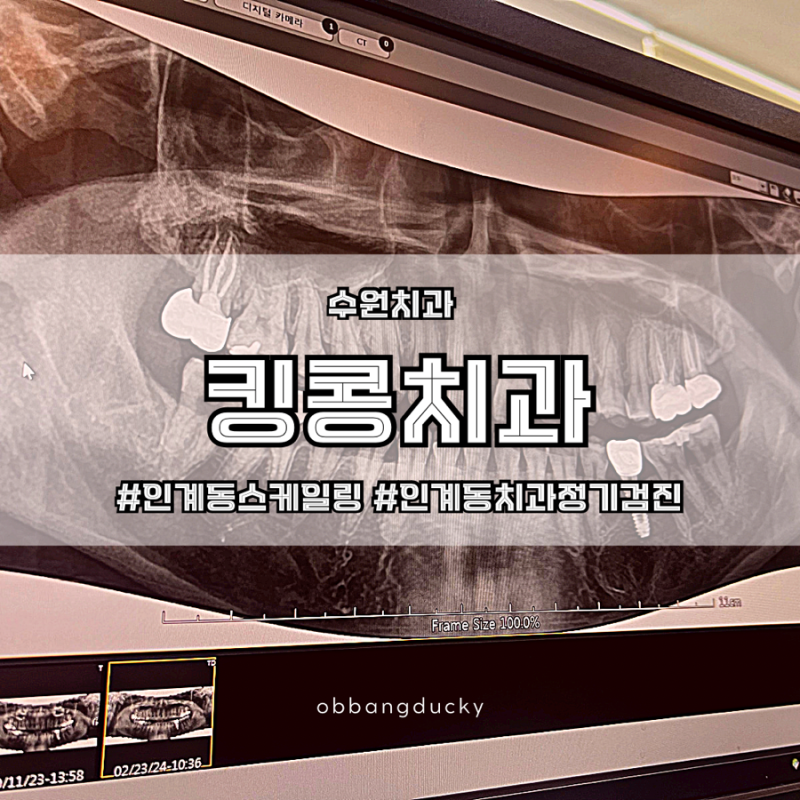 수원 인계동 치과케이스 정리방법