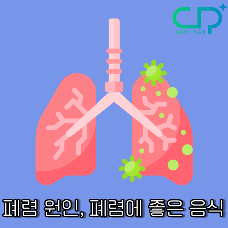 폐렴 원인, 증상 : 폐렴에 좋은 음식