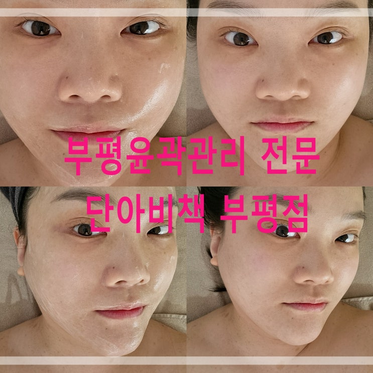  부평윤곽관리 전문점 단아비책 부평점 수근골윤곽관리 대만족 후기 추천
