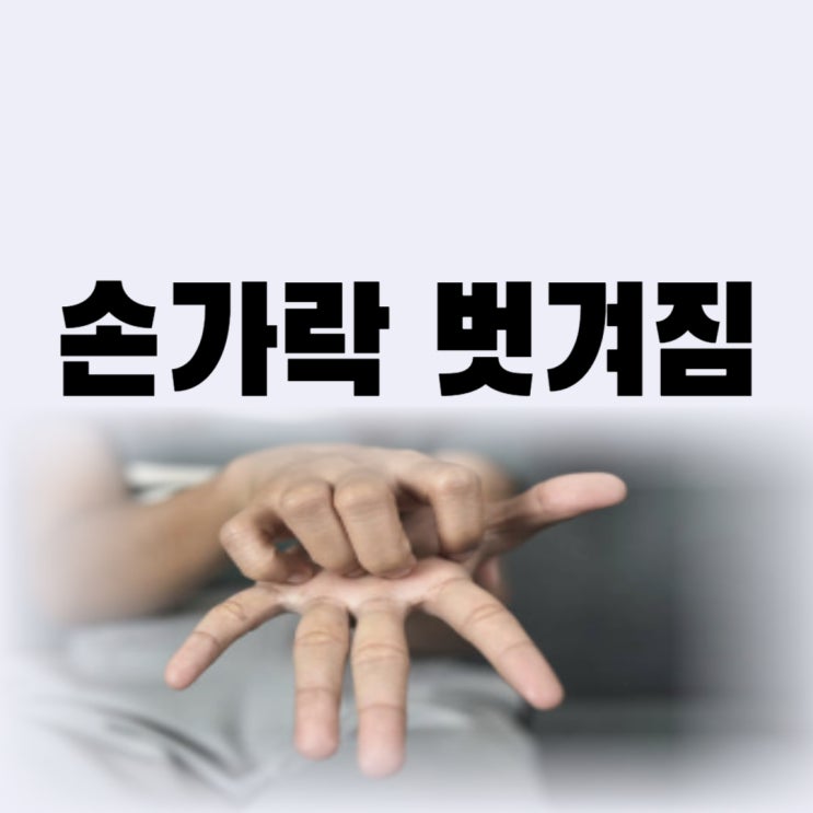  손 손가락 피부 껍질 벗겨짐 원인부터 치료 연고 까지