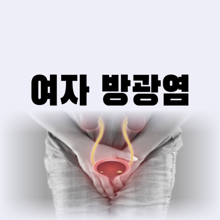  여자 방광염 증상 어떤 원인으로 발생하는 걸까