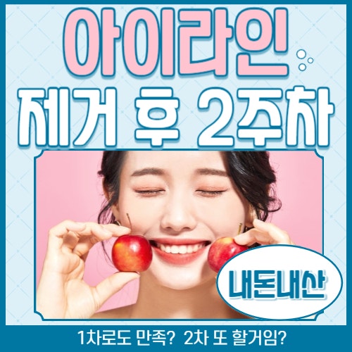  반영구 아이라인 제거 후기, 8일~14일차(1차 제거는 얼마나 깔끔하게?)