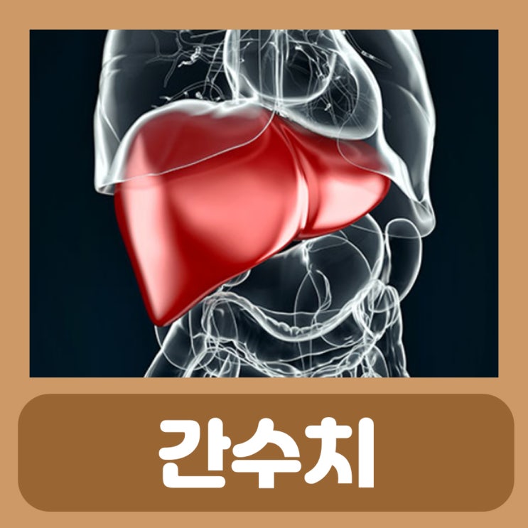  간수치 AST ALT ALP 감마지티피 GTP GGT 수치 정상범위 간수치 높을때 증상 낮추는법 간수치가 높은 이유