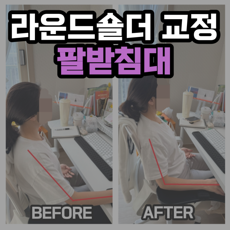  팔받침대 내돈내산 후기 /직장인 사무직 라운드숄더 해결