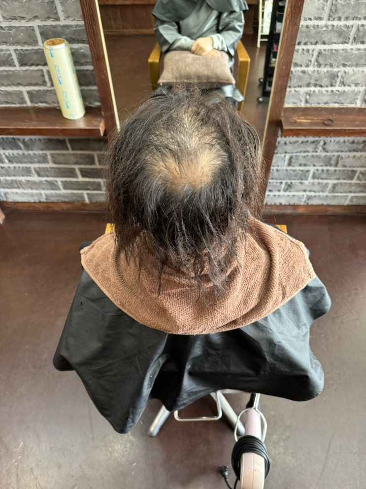  천안 링거펌 전문 미용실 더본헤어 남성탈모 링거펌  모류교정으로 완벽커버