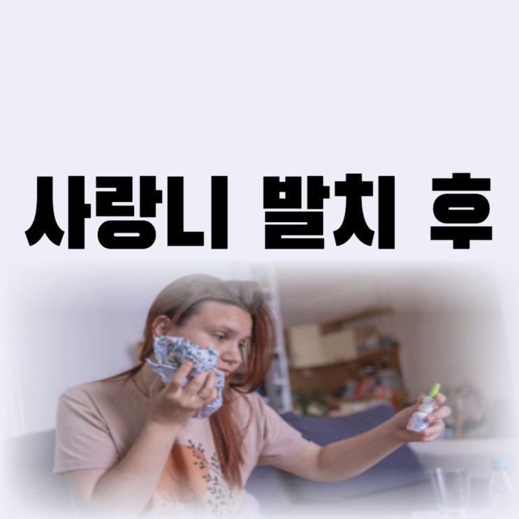 매복 사랑니 발치 후 운동 흡연 음식 식사 술 언제부터(주의사항)