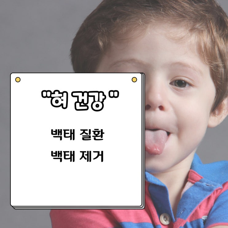  혀 백태 원인 질환 건강상태 현직 간호사의 제거방법