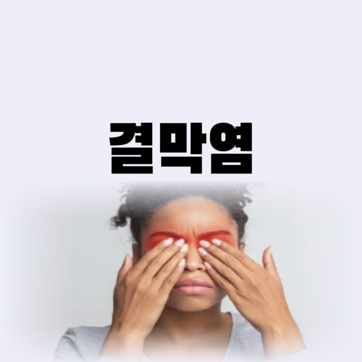  알레르기성 결막염 증상 있을 때 렌즈 착용해도 될까(전염)