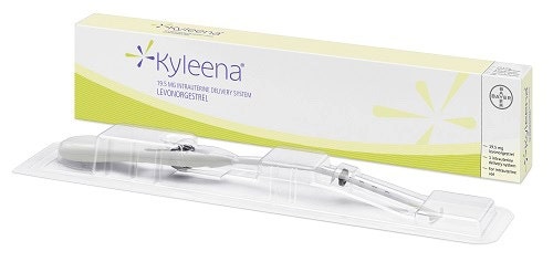  카일리나 IUD 루프 시술 5년차 후기