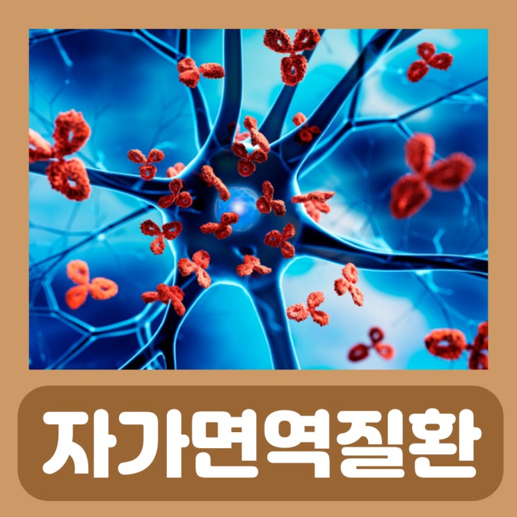  자가면역질환 종류 전신경화증 레이노증후군