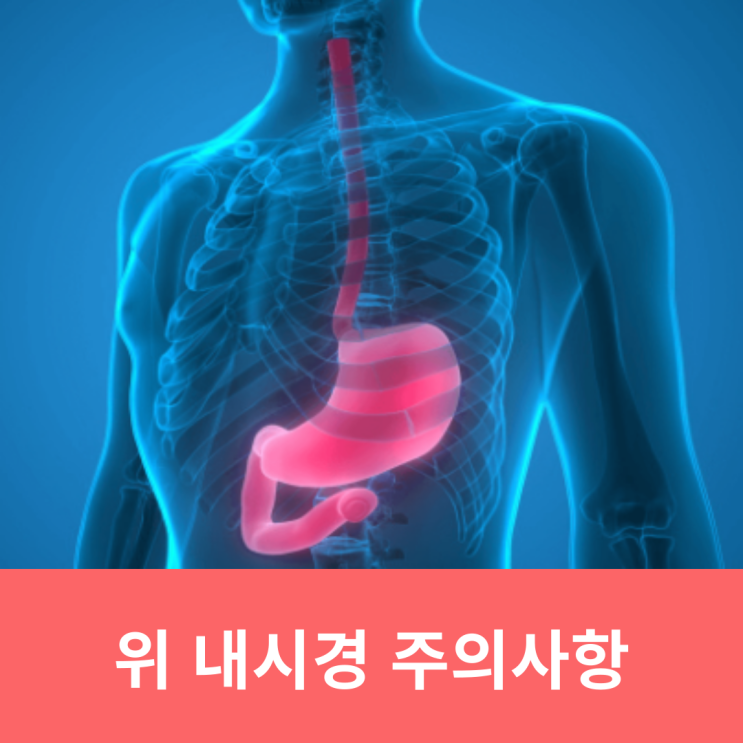  위내시경 검사 전 주의사항 금식 시간 : 물먹어도 될까