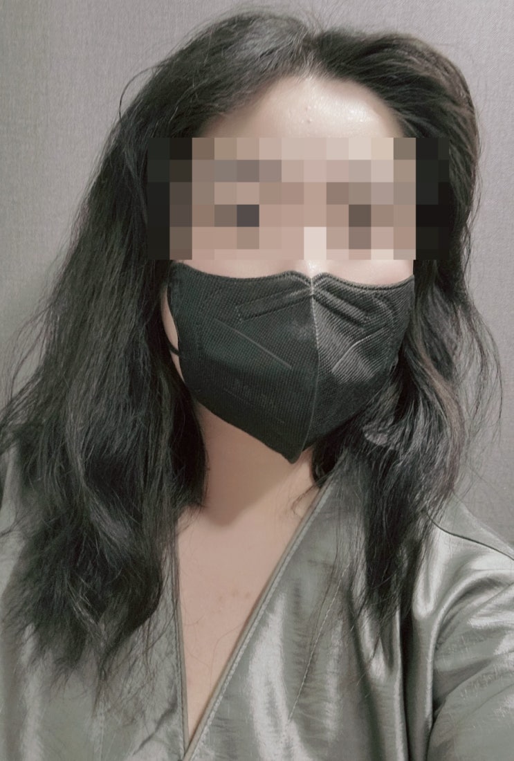  실킨제모, 종아리제모 겨드랑이 레이저 제모 후기 2차!