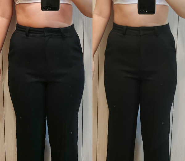  체지방 -2.4kg 인천 구월동 피부과 다이어트 5주차