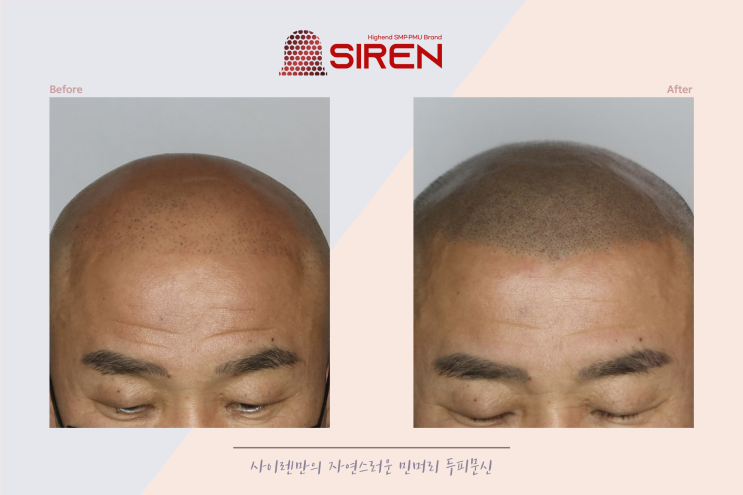 창원두피문신 티안나게 자연스럽게