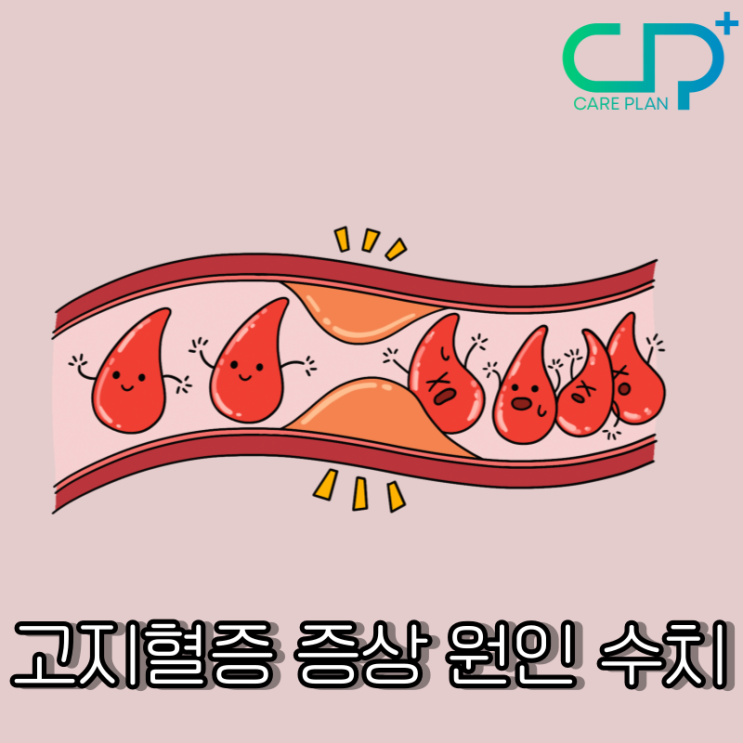  고지혈증 증상 원인 수치 : 좋은 음식