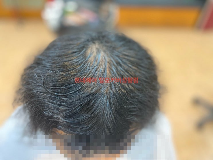  탈모꿀팁 탈모커버성형펌 부산 사상구 르네시떼7층미용실/ 주례감전개금학장하단다대김해장유양산울산대저명지녹산모하덕천화명서면전포양정수영망미토곡광안해운대민락용호남천초량영도남포연제동래명륜