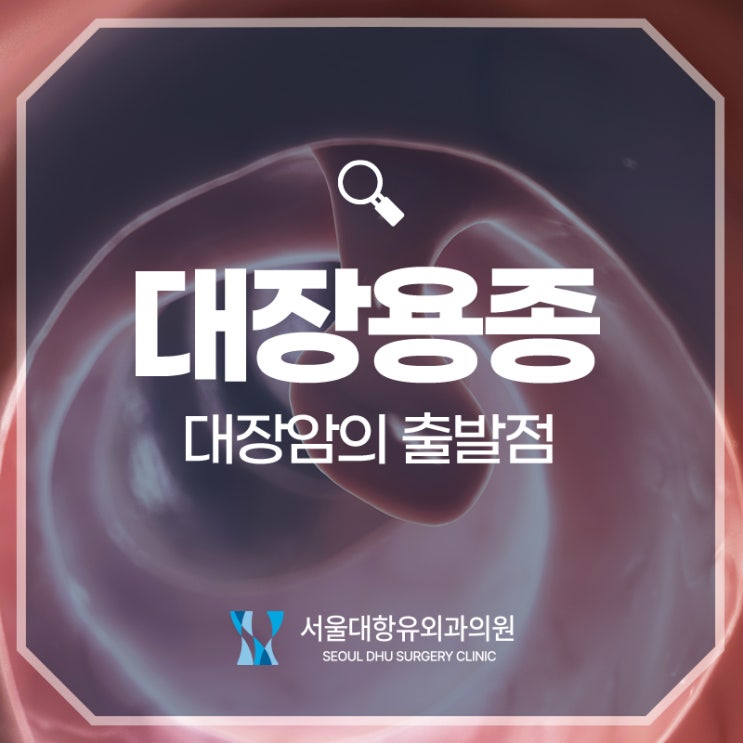  대장용종, 대장암의 출발점. 고위험에 해당되는 경우는?