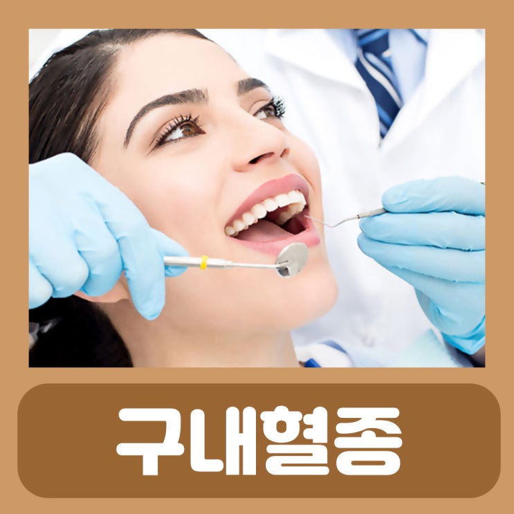  구내혈종 치료 입안 피멍울 증상