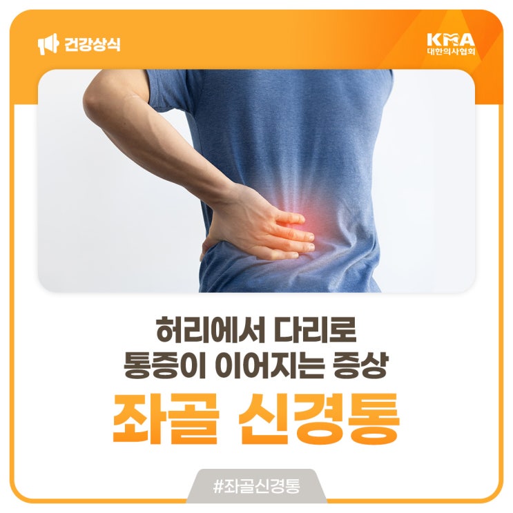  좌골 신경통, 허리에서 다리로 통증이 이어지는 증상