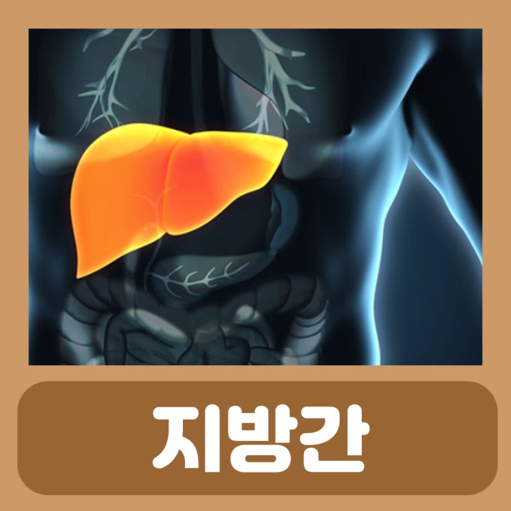  지방간 치료 방법 약 증상 원인 알콜성 비알콜성 지방간 지방간에 좋은 음식