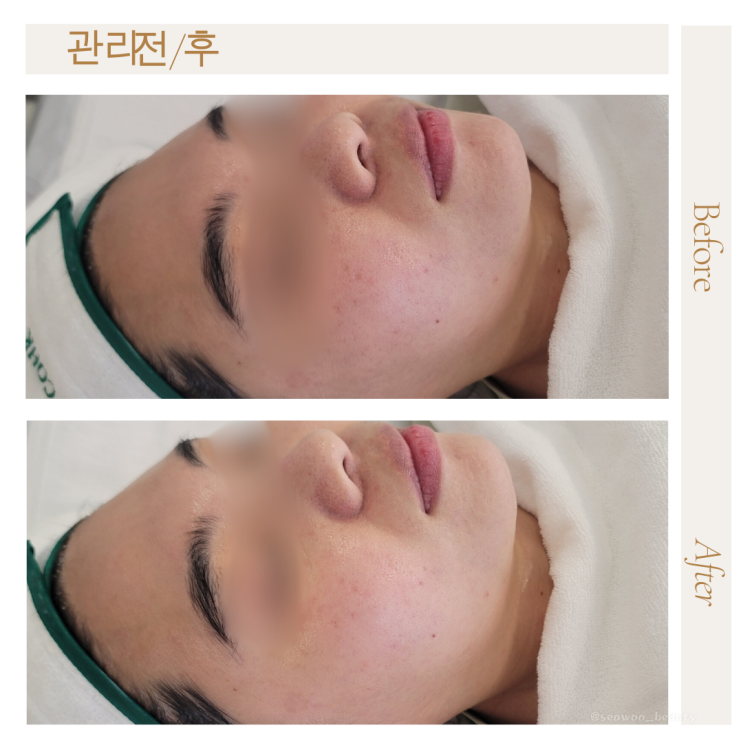  ※ 윤곽관리는 옥정 서우뷰티에서 ※