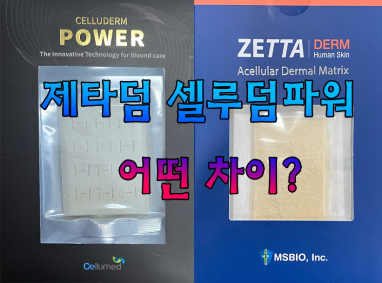 [남자확대수술 남성의원] 제타덤과 셀루덤파워 진피 비교 차이점?