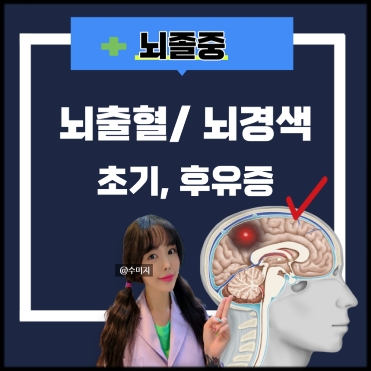  뇌졸중 초기증상 뇌출혈 뇌경색 전조증상 후유증 (중풍)