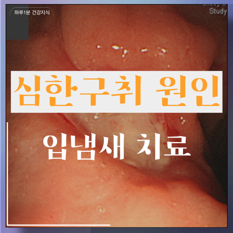  구취 원인 심한구취 입냄새 원인 치료