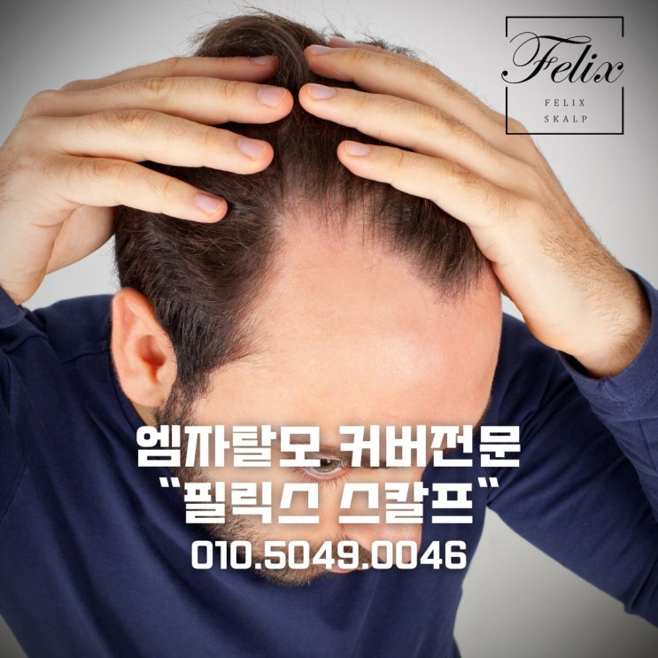  마산동두피문신!탈모커버 확실하게!