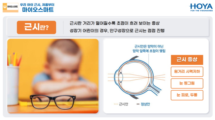  마이오스마트 대전 이안경원 둔산점 아이근시 안경 새학기 맞이 근시억제렌즈 전문 안경원 이안경원 둔산점 Miyosmart렌즈