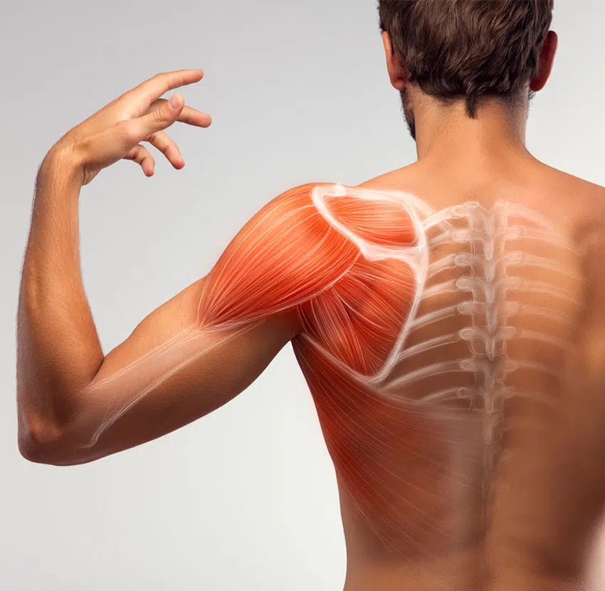 양천구 정형외과 ,    사진출처:https://biofunctionalhealth.com/blog/condition/shoulder-impingement-syndrome/