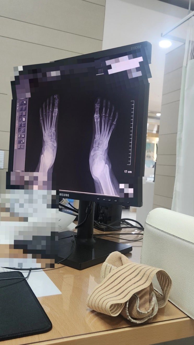  불쌍한 내 다리..
