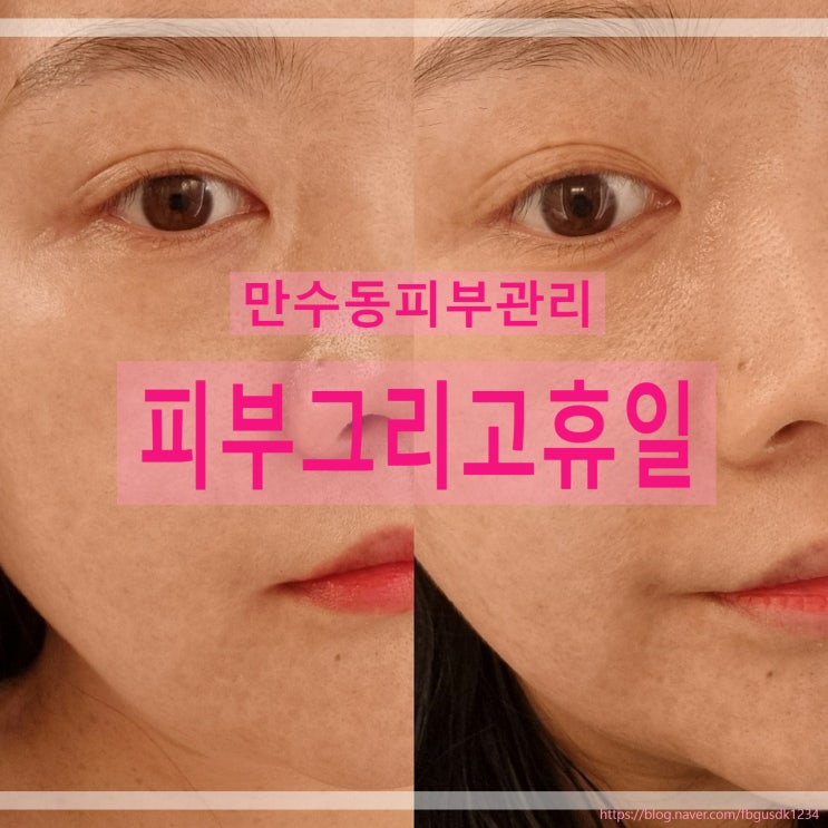  만수동피부관리 잘하는 곳 피부그리고휴일 보습관리추천