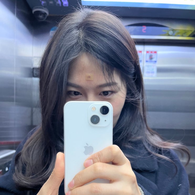 홍대 수두자국제거 새살침 치료 후기 홍대 수두자국제거 새살침 치료 후기