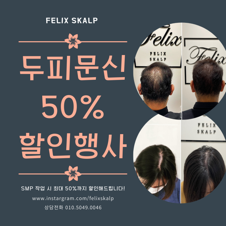  사우동 두피문신 필릭스스칼프에서 제대로!