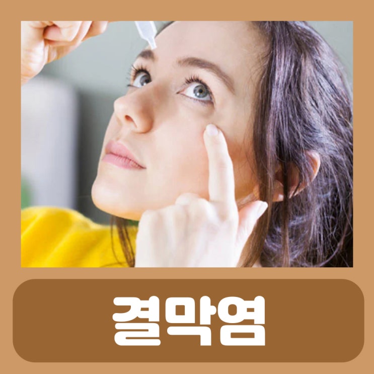  결막염 치료 눈병 증상 전염 치료 안약 유행성 알레르기성 결막염