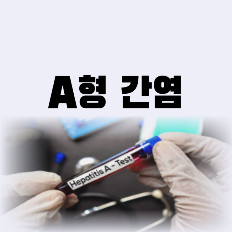  A형 간염 예방접종 가격 비용 시기 언제일까